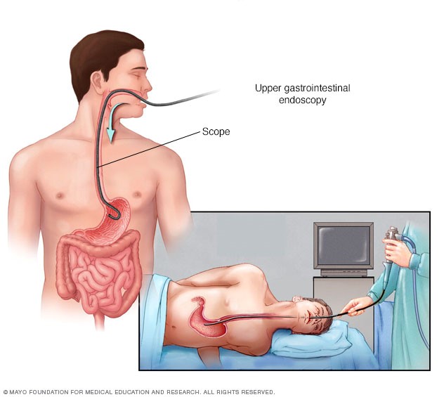 It's important to be tested for Celiac Disease before trying a gluten-free diet. 